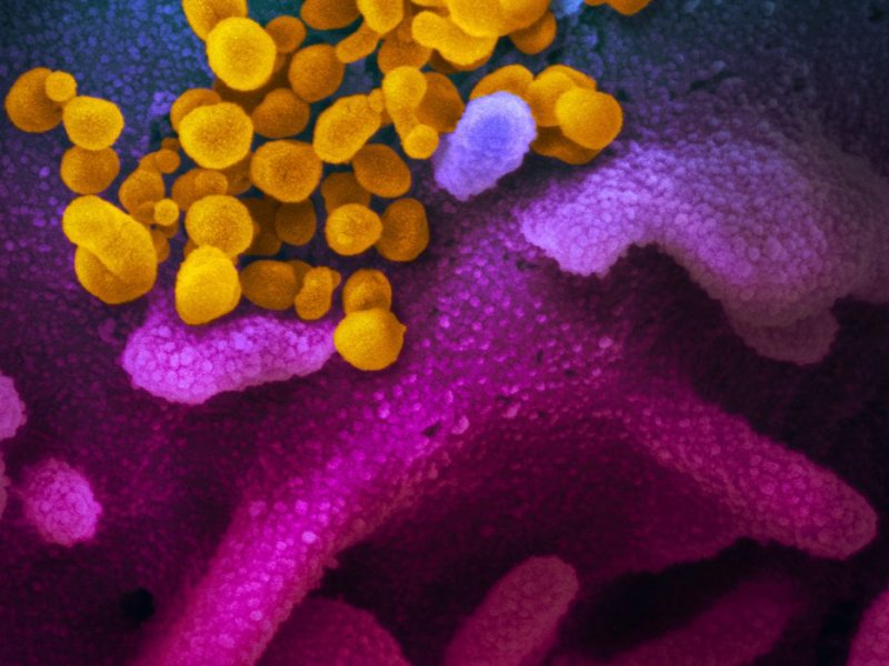 Covid-19: estudo aponta aumento de bactérias resistentes em UTIs