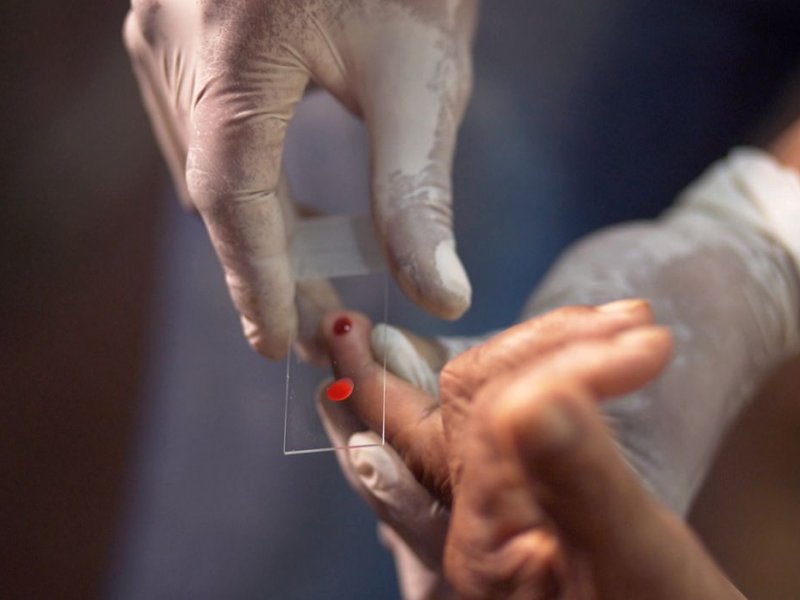 Ministério da Saúde quer zerar casos de malária no país até 2035
